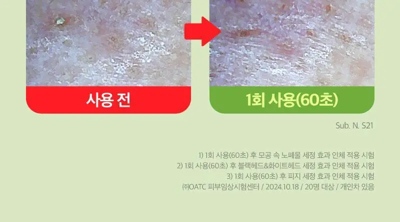 [모공개선] 리덴스 청포도 포어 스케일링 클렌징오일 200mL 상세페이지 19